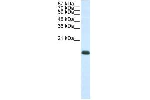 ZNF786 antibody (20R-1235) used at 0. (ZNF786 Antikörper  (N-Term))