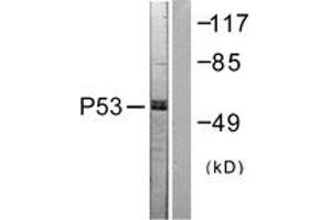 Western blot analysis of extracts from 293 cells, treated with Etoposide 25uM 60', using p53 (Ab-392) Antibody. (p53 Antikörper  (AA 344-393))