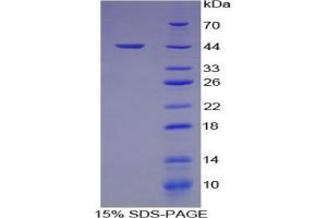 SDS-PAGE analysis of Human Hemojuvelin Protein. (HFE2 Protein)