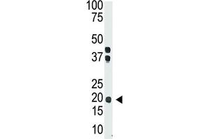 Western Blotting (WB) image for anti-Interleukin 28 (IL28) antibody (ABIN2999201) (IL-28 Antikörper)