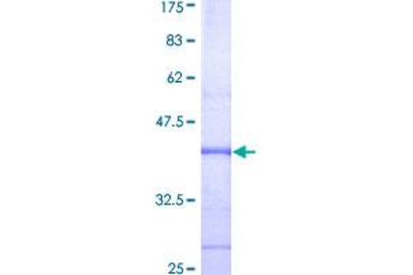 Nerve Growth Factor Protein (NGF) (AA 200-299) (GST tag)