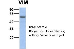 Host:  Rabbit  Target Name:  VIM  Sample Type:  Human Fetal Lung  Antibody Dilution:  1. (Vimentin Antikörper  (C-Term))