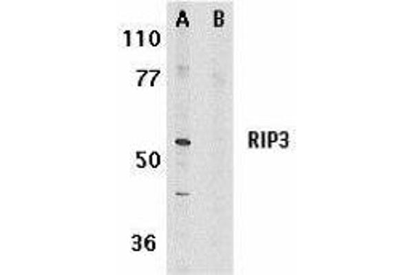 MPRIP Antikörper  (AA 473-486)