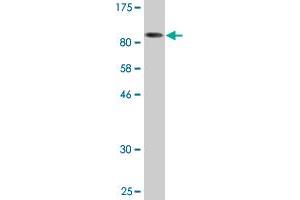 Western Blot detection against Immunogen (142. (HDAC6 Antikörper  (AA 1-1063))