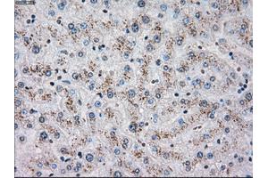 Immunohistochemical staining of paraffin-embedded liver tissue using anti-CHEK2mouse monoclonal antibody. (CHEK2 Antikörper)
