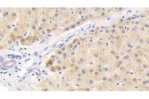 Detection of MAPKAP1 in Human Liver Tissue using Polyclonal Antibody to Mitogen Activated Protein Kinase Associated Protein 1 (MAPKAP1) (MAPKAP1 Antikörper  (AA 8-236))