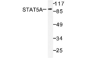 Image no. 1 for anti-Signal Transducer and Activator of Transcription 5A (STAT5A) antibody (ABIN271829) (STAT5A Antikörper)