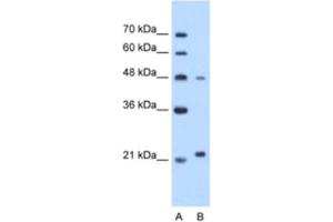 Western Blotting (WB) image for anti-Matrix Metallopeptidase 1 (Interstitial Collagenase) (MMP1) antibody (ABIN2462517) (MMP1 Antikörper)