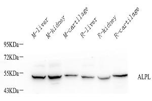 Western Blot analysis of various samples using ALPL Polyclonal Antibody at dilution of 1:1000. (ALPL Antikörper)