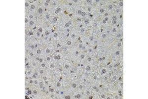 Immunohistochemistry of paraffin-embedded mouse liver using SKP2 antibody (ABIN5995995) at dilution of 1/100 (40x lens). (SKP2 Antikörper)