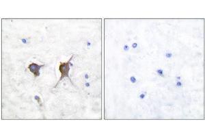 Immunohistochemistry (IHC) image for anti-BCL2-Associated X Protein (BAX) (N-Term) antibody (ABIN1848439) (BAX Antikörper  (N-Term))