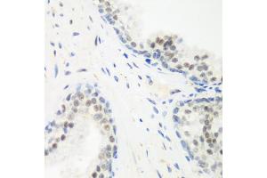 Immunohistochemistry of paraffin-embedded human prostate using PPAN antibody. (PPAN Antikörper)