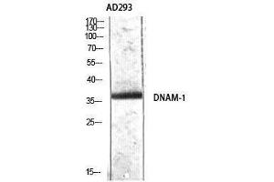 Western Blotting (WB) image for anti-CD226 (CD226) (Tyr570) antibody (ABIN3174791) (CD226 Antikörper  (Tyr570))