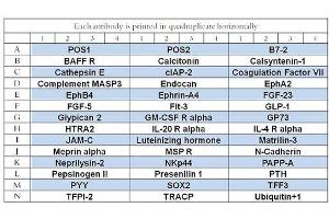 Image no. 1 for Human Cytokine Array Q12 (ABIN4956045) (Human Cytokine Array Q12)