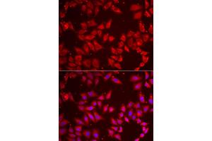 Immunofluorescence analysis of HeLa cells using BAP1 antibody (ABIN5973917). (BAP1 Antikörper)