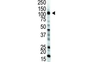 Western Blotting (WB) image for anti-E1 Ubiquitin antibody (ABIN3001449) (E1 Ubiquitin Antikörper)