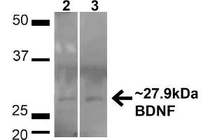 Western blot analysis of Human HeLa and HEK293T cell lysates showing detection of ~27. (BDNF Antikörper  (N-Term) (PerCP))