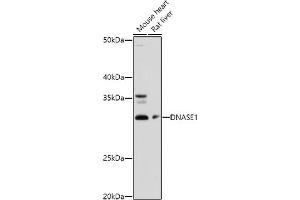 Western blot analysis of extracts of various cell lines, using DN antibody (ABIN3016214, ABIN3016215, ABIN3016216, ABIN1679557 and ABIN6219627) at 1:1000 dilution. (DNASE1 Antikörper  (AA 22-282))