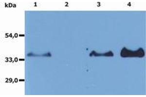 Image no. 1 for anti-Membrane-Spanning 4-Domains, Subfamily A, Member 1 (MS4A1) antibody (ABIN1100549) (CD20 Antikörper)