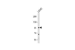 Western Blotting (WB) image for anti-Epidermal Growth Factor Receptor Pathway Substrate 8 (EPS8) (AA 9-39), (N-Term) antibody (ABIN392773)