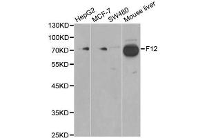 Western blot analysis of extracts of various cell lines, using F12 antibody (ABIN5970845) at 1/1000 dilution. (F12 Antikörper)