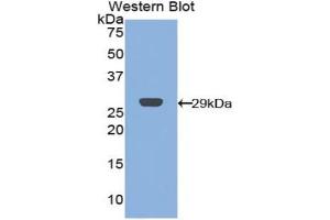 Detection of Recombinant CRP,Cavia using Polyclonal Antibody to C Reactive Protein (CRP) (CRP Antikörper  (AA 20-225))