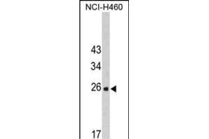 Western blot analysis of FKBP14 Antibody (N-term) (ABIN390491 and ABIN2840850) in NCI- cell line lysates (35 μg/lane). (FKBP14 Antikörper  (N-Term))