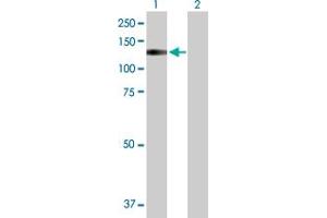 Lane 1: TRPA1 transfected lysate ( 123. (TRPA1 293T Cell Transient Overexpression Lysate(Denatured))