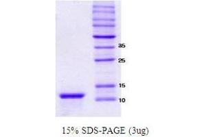 Figure annotation denotes ug of protein loaded and % gel used. (alpha Synuclein 112 (NACP112) (active) Protein)