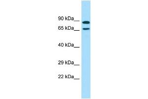 WB Suggested Anti-POF1B Antibody Titration: 1. (POF1B Antikörper  (C-Term))