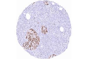 Pancreas with intense nuclear Pax6 staining of islet cells scaled (PAX6 Antikörper)