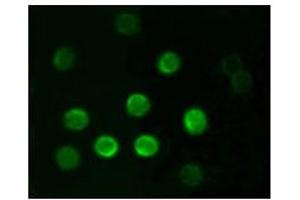 Immunofluorescence analysis of B lymphocytes using CD20 mouse mAb. (CD20 Antikörper)