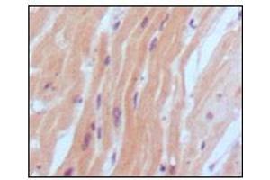 Immunohistochemical analysis of paraffin-embedded human normal myocardium, showing cytoplasmic localization using BNP2 antibody with DAB staining. (BNP Antikörper)