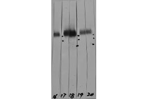 Western strip blots of HeLa cell crude extracts with two different preparations of ABIN1580432 in strips 17 and 18. (LAMP1 Antikörper)