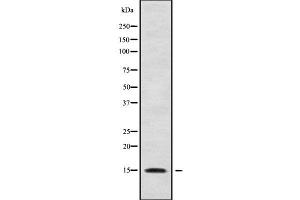 Western blot analysis of RPS24 using HepG2 whole cell lysates (RPS24 Antikörper  (Internal Region))