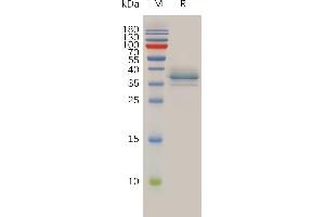 Human A Protein, His Tag on SDS-PAGE under reducing condition. (Annexin a1 Protein (AA 2-346) (His tag))