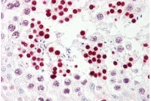 Anti-p53 antibody IHC staining of human testis. (p53 Antikörper  (AA 344-393))
