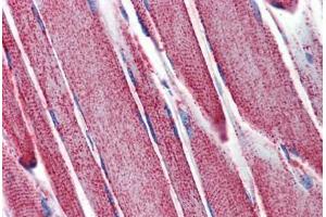 Skeletal muscle, Human: Formalin-Fixed, Paraffin-Embedded (FFPE) (SOD2 Antikörper)