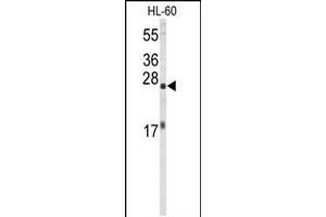 Western blot analysis of EIF4E Antibody in HL-60 cell line lysates (35ug/lane) (EIF4E Antikörper)