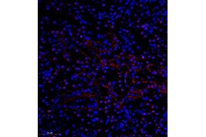 Immunofluorescence of paraffin embedded mouse nephritis using pax2 (ABIN7074974) at dilution of 1:600 (300x lens) (PAX2A Antikörper)