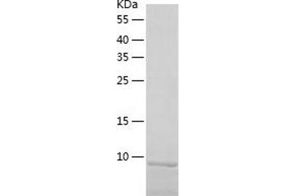 LSM5 Protein (AA 1-91) (His tag)