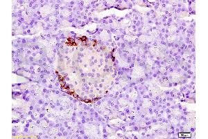 Immunohistochemistry (IHC) image for anti-Coagulation Factor III (thromboplastin, Tissue Factor) (F3) (AA 32-100) antibody (ABIN708086)