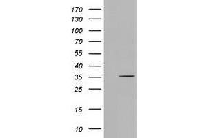 HEK293T cells were transfected with the pCMV6-ENTRY control (Left lane) or pCMV6-ENTRY SDR9C7 (Right lane) cDNA for 48 hrs and lysed. (SDR9C7 Antikörper)