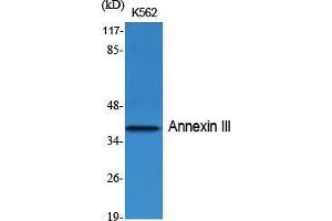 Western Blot (WB) analysis of specific cells using Annexin III Polyclonal Antibody. (Annexin A3 Antikörper  (Internal Region))