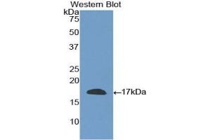 Detection of Recombinant CD40L, Human using Polyclonal Antibody to Cluster Of Differentiation 40 Ligand (CD40L) (CD40 Ligand Antikörper  (AA 180-261))