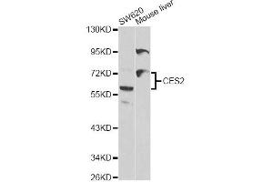 Western blot analysis of extracts of various cell lines, using CES2 antibody (ABIN5970708) at 1/1000 dilution. (CES2 Antikörper)