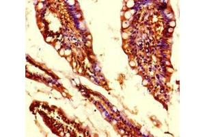 Immunohistochemistry of paraffin-embedded human small intestine tissue using ABIN7159156 at dilution of 1:100 (MED31 Antikörper  (AA 2-72))