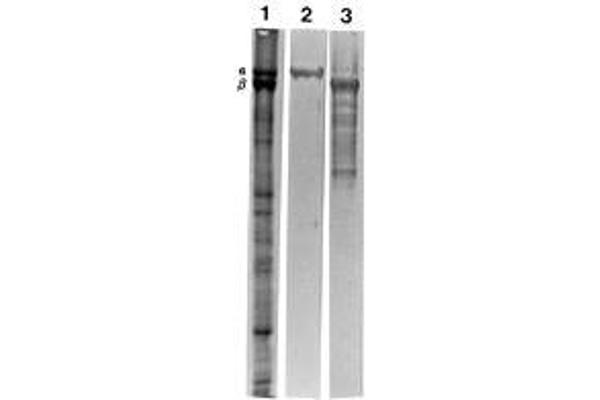 Spectrin beta Chain, Erythrocyte (SPTB) Antikörper