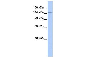 Western Blotting (WB) image for anti-diphosphoinositol Pentakisphosphate Kinase 2 (PPIP5K2) antibody (ABIN2459863) (HISPPD1 Antikörper)