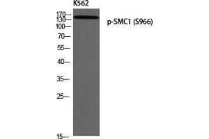 Western Blot (WB) analysis of K562 using p-SMC1 (S966) antibody. (SMC1A Antikörper  (pSer966))